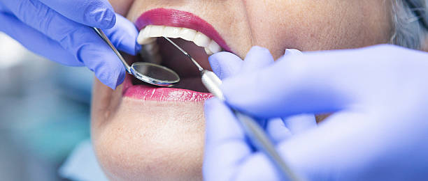 Best Chipped Tooth Repair Near Me  in Running Springs, CA